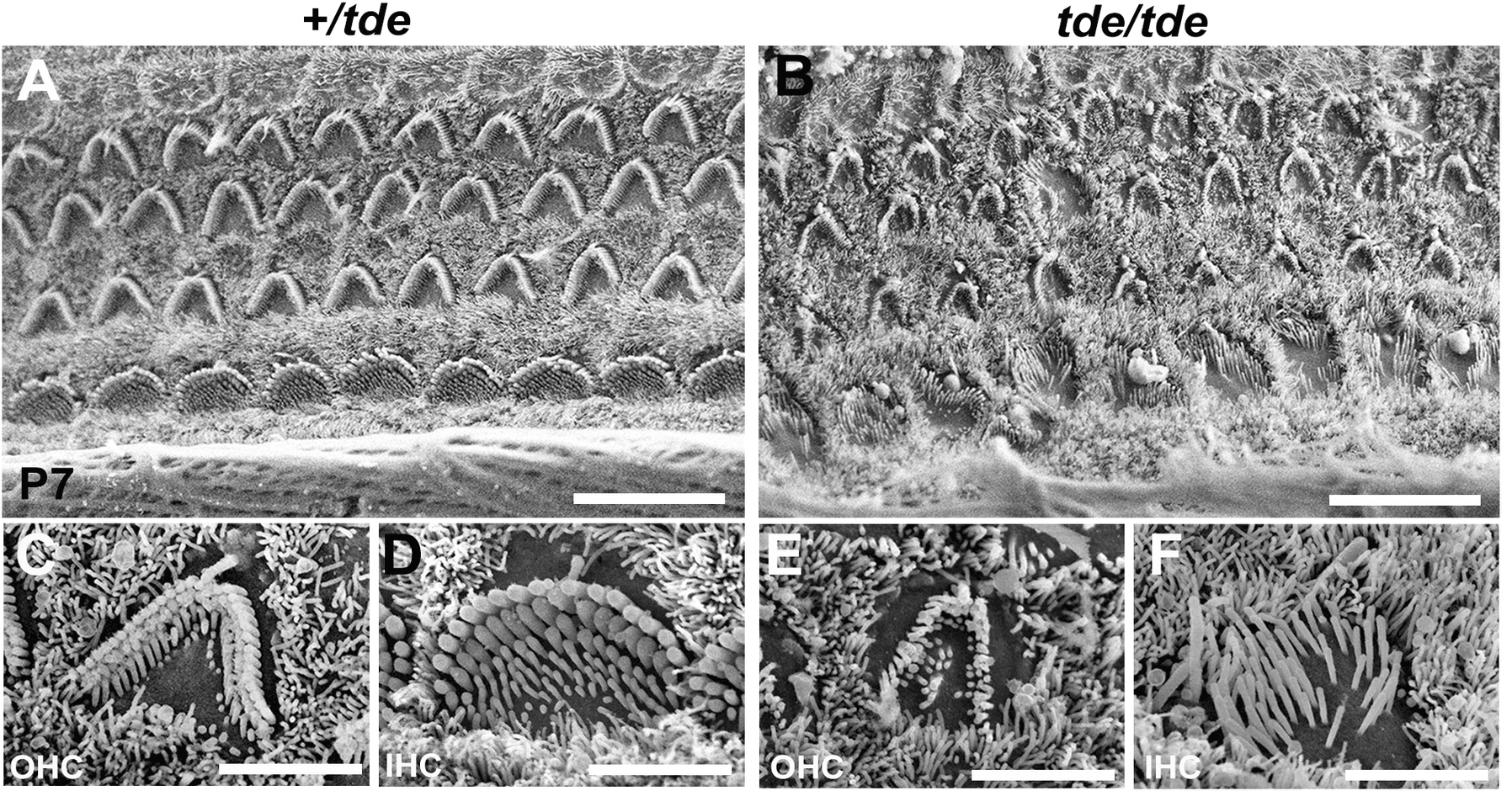 How a Single Gene Causes Deafness — And How Gene Therapy Just Fixed It